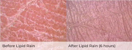 Lipid Rain
